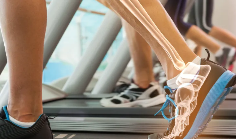 People walk on treadmills.